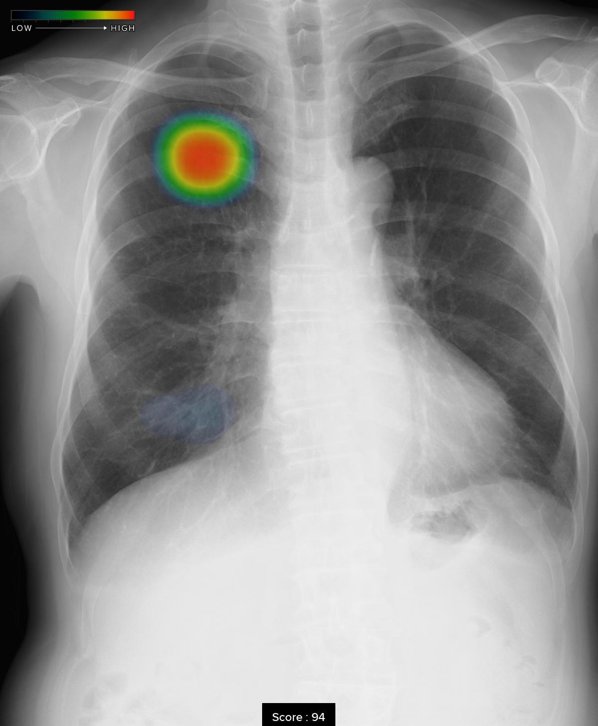 局所解剖と画像診断 Canal Foramen, Fissure, Space & Membrane 読影の手立てとなる